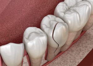 Where is the Best dentist 98115?